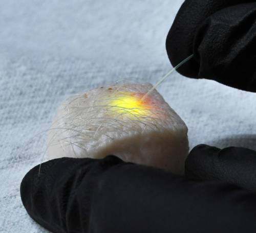 Introducerea unei fibre optice pentru extragerea luminii laser