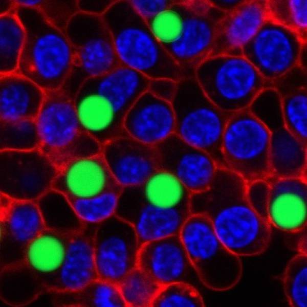 Laserele de culoare verde luminează în interiorul celulelor