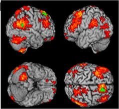 Modele de regiuni cerebrale specifice depresiei