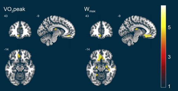 Exercițiul cardio îmbunătățește sănătatea creierului