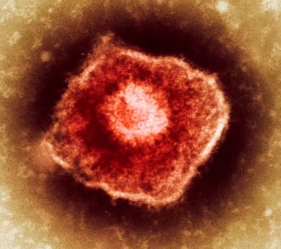 Virusul varicelo-zosterian
