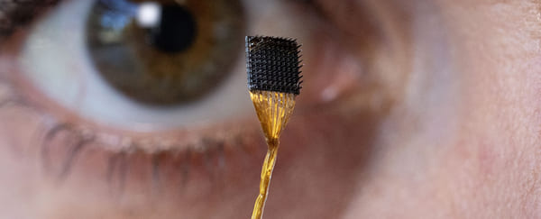 Implant cerebral Implant cerebral