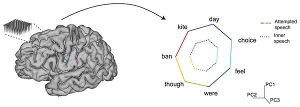 Învățarea mașină în interfața creier-computer Învățarea mașină în interfața creier-computer