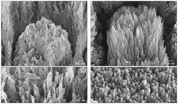 Creșterea smaltului dentar Cresterea smaltului dentar